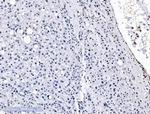 SF1 Antibody in Immunohistochemistry (Paraffin) (IHC (P))