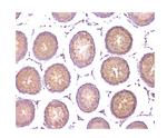 WWOX Antibody in Immunohistochemistry (Paraffin) (IHC (P))