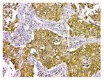 STUB1 Antibody in Immunohistochemistry (Paraffin) (IHC (P))