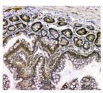 STUB1 Antibody in Immunohistochemistry (Paraffin) (IHC (P))