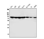 PARN Antibody in Western Blot (WB)