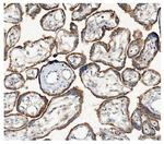 HK1 Antibody in Immunohistochemistry (Frozen) (IHC (F))