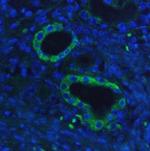 HK1 Antibody in Immunohistochemistry (Paraffin) (IHC (P))