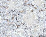 FABP4 Antibody in Immunohistochemistry (Paraffin) (IHC (P))