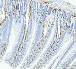 FABP4 Antibody in Immunohistochemistry (Paraffin) (IHC (P))