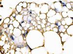 FABP4 Antibody in Immunohistochemistry (Paraffin) (IHC (P))