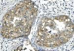 BUBR1 Antibody in Immunohistochemistry (Paraffin) (IHC (P))