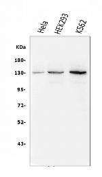 BUBR1 Antibody in Western Blot (WB)