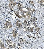 Catenin alpha-1 Antibody in Immunohistochemistry (Paraffin) (IHC (P))