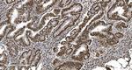 Ku70 Antibody in Immunohistochemistry (Paraffin) (IHC (P))