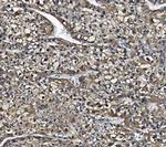 CES1 Antibody in Immunohistochemistry (Paraffin) (IHC (P))