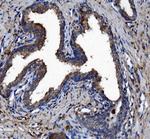 CES1 Antibody in Immunohistochemistry (Paraffin) (IHC (P))