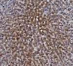 CES1 Antibody in Immunohistochemistry (Paraffin) (IHC (P))