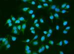 SHIP2 Antibody in Immunocytochemistry (ICC/IF)