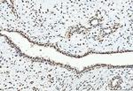 CtBP2 Antibody in Immunohistochemistry (Paraffin) (IHC (P))