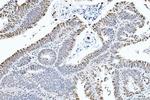 CtBP2 Antibody in Immunohistochemistry (Paraffin) (IHC (P))