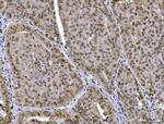 CtBP2 Antibody in Immunohistochemistry (Paraffin) (IHC (P))