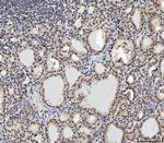 CtBP2 Antibody in Immunohistochemistry (Paraffin) (IHC (P))