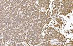 SND1 Antibody in Immunohistochemistry (Paraffin) (IHC (P))