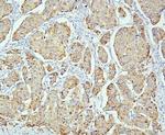 PPT1 Antibody in Immunohistochemistry (Paraffin) (IHC (P))