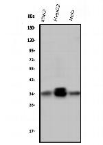 PPT1 Antibody in Western Blot (WB)