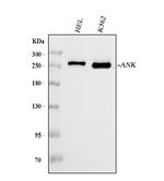 Ankyrin 1 Antibody in Western Blot (WB)