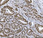 RCC1 Antibody in Immunohistochemistry (Paraffin) (IHC (P))