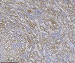 ILK Antibody in Immunohistochemistry (Paraffin) (IHC (P))