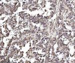 TRIM24 Antibody in Immunohistochemistry (Paraffin) (IHC (P))