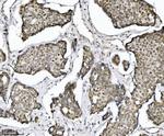 TRIM24 Antibody in Immunohistochemistry (Paraffin) (IHC (P))