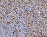 ME1 Antibody in Immunohistochemistry (Paraffin) (IHC (P))