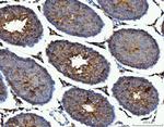 ME1 Antibody in Immunohistochemistry (Paraffin) (IHC (P))