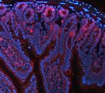 NKCC1 Antibody in Immunohistochemistry (Paraffin) (IHC (P))