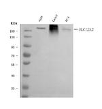 NKCC1 Antibody in Western Blot (WB)