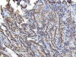 DDX1 Antibody in Immunohistochemistry (Paraffin) (IHC (P))