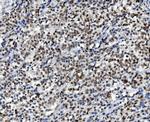 DDX1 Antibody in Immunohistochemistry (Paraffin) (IHC (P))