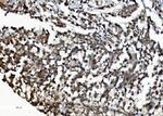 DDX1 Antibody in Immunohistochemistry (Paraffin) (IHC (P))