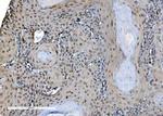 DDX1 Antibody in Immunohistochemistry (Paraffin) (IHC (P))