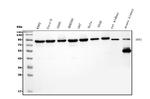 DDX1 Antibody in Western Blot (WB)