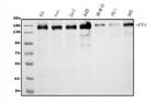 AFF4 Antibody in Western Blot (WB)