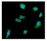 DDX6 Antibody in Immunocytochemistry (ICC/IF)