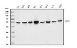 DDX6 Antibody in Western Blot (WB)