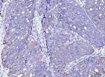 ACSL4 Antibody in Immunohistochemistry (Paraffin) (IHC (P))