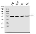 eIF5 Antibody in Western Blot (WB)