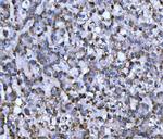 WDR1 Antibody in Immunohistochemistry (Paraffin) (IHC (P))