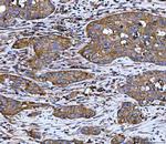 WDR1 Antibody in Immunohistochemistry (Paraffin) (IHC (P))