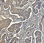 Aldolase A Antibody in Immunohistochemistry (Paraffin) (IHC (P))