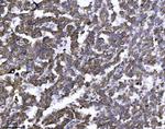 ERLIN2 Antibody in Immunohistochemistry (Paraffin) (IHC (P))