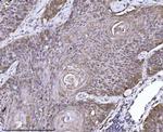 ERLIN2 Antibody in Immunohistochemistry (Paraffin) (IHC (P))