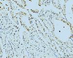 PSMC3 Antibody in Immunohistochemistry (Paraffin) (IHC (P))